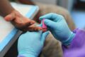 Estudo aponta alta prevalência de doença cardiovascular silenciosa em adultos com diabetes tipo 2