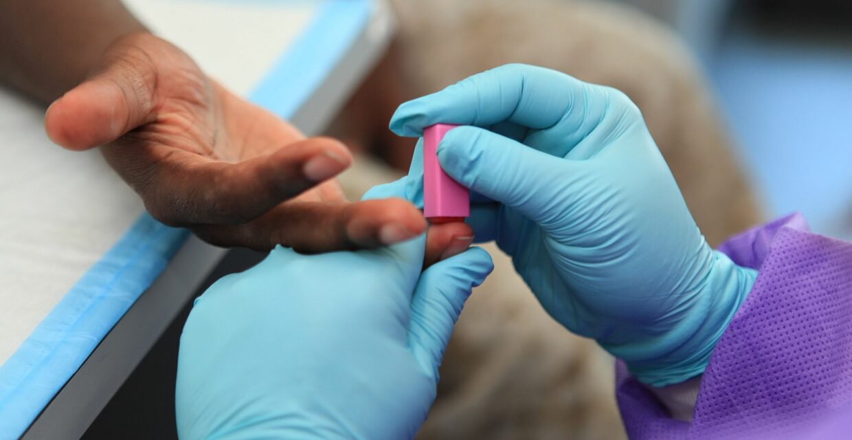 Estudo revela alta prevalência de doença cardiovascular silenciosa em adultos com diabetes tipo 2